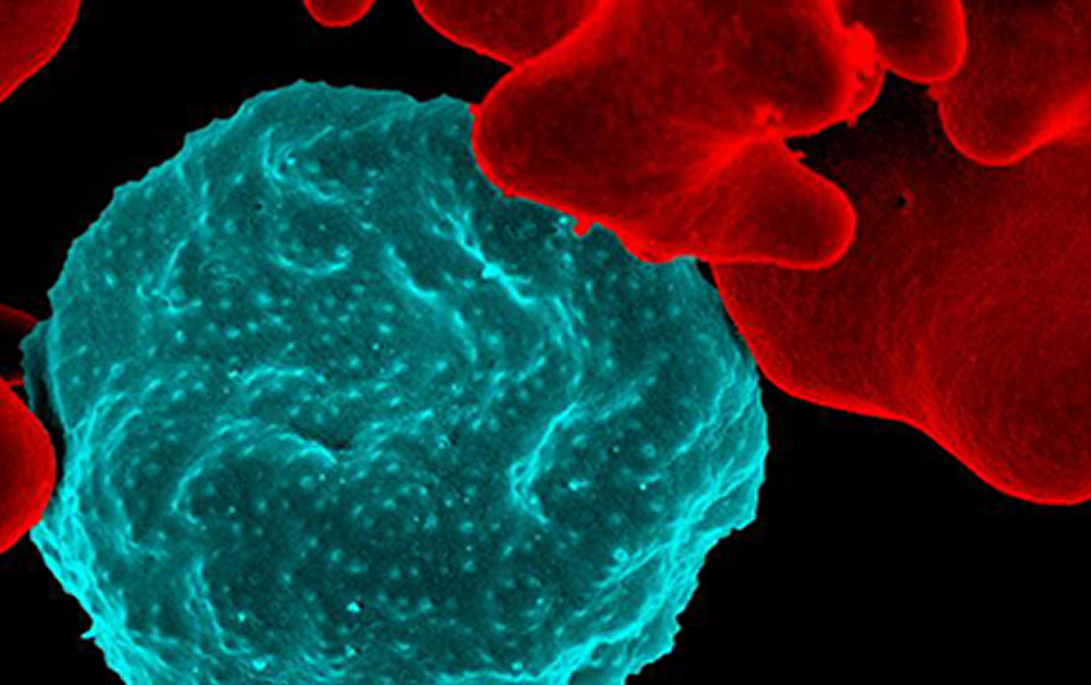 在電子顯微鏡照片中，被瘧原蟲感染的紅細胞為藍色，未感染的紅細胞為紅色。